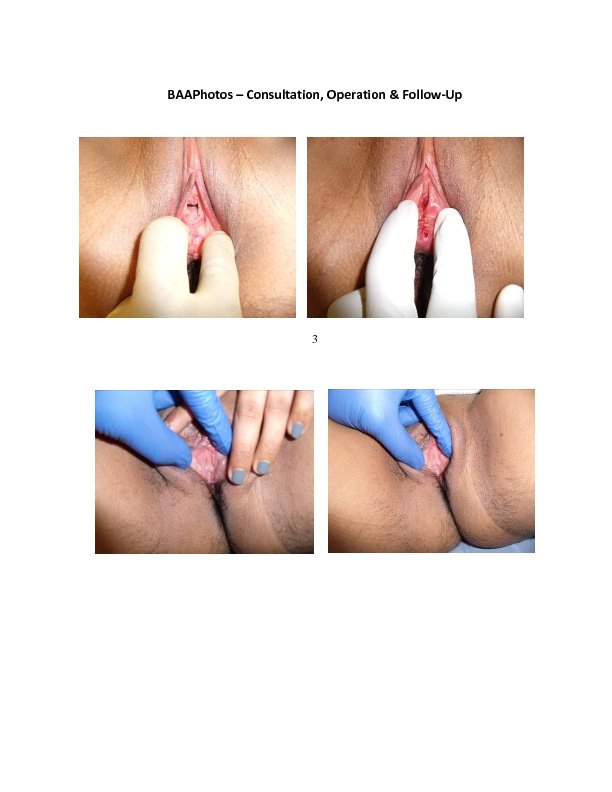 GyneClinics @ Airedale NHS - GyneClinics @ Airedale NHS