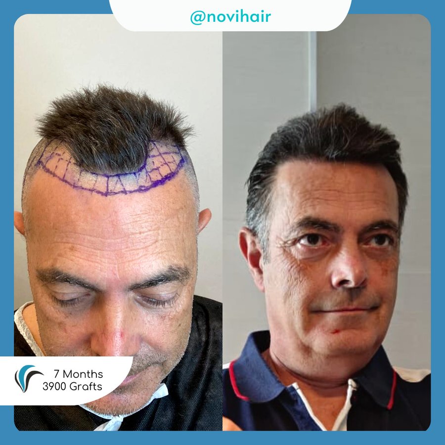 الشعر Avrasya - Hair Avrasya