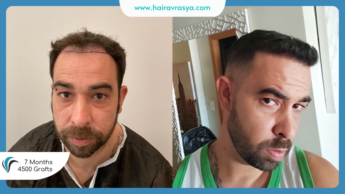 الشعر Avrasya - Hair Avrasya