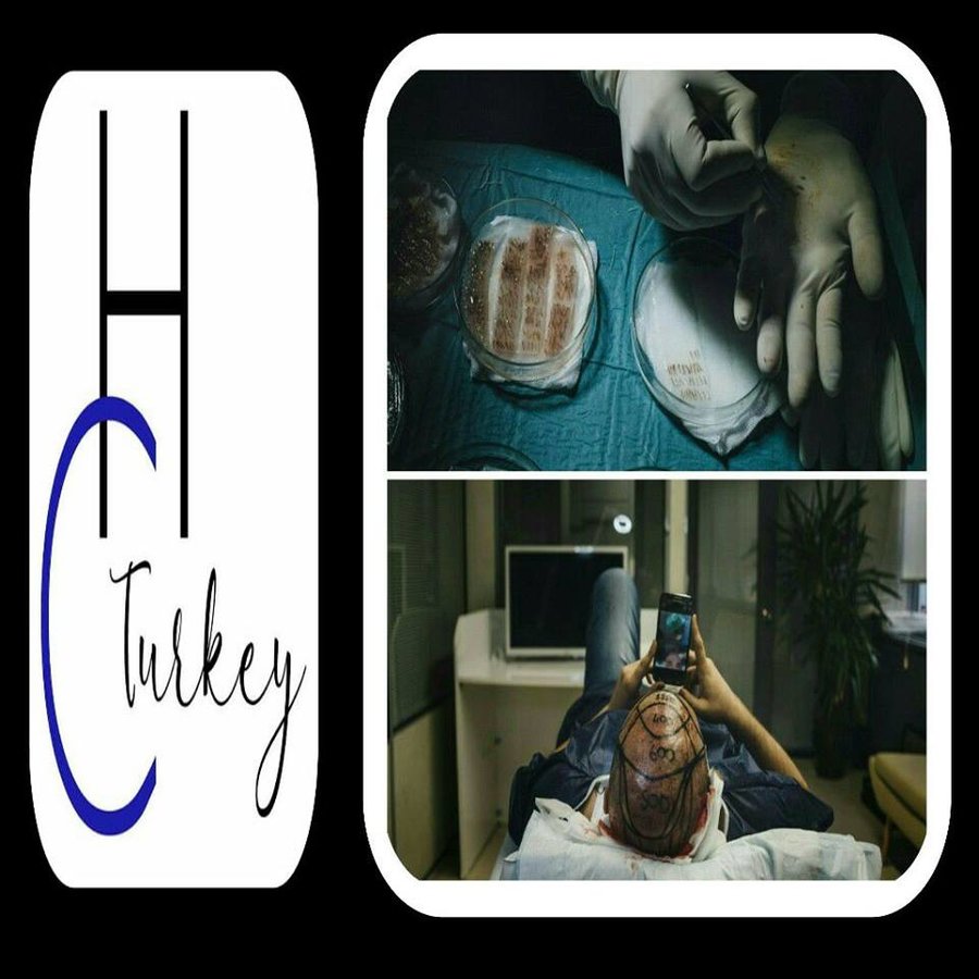 Hair Care Turkey - Hair Care Turkey
