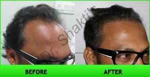 Hair Harmony and You - Bhubaneswar - Hair Harmony and You - Bhubaneswar