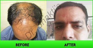 Hair Harmony and You - Bhubaneswar - Hair Harmony and You - Bhubaneswar