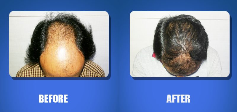 Hair Harmony and You - Bhubaneswar - Hair Harmony and You - Bhubaneswar