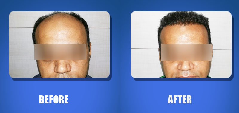 Hair Harmony and You - Bhubaneswar - Hair Harmony and You - Bhubaneswar