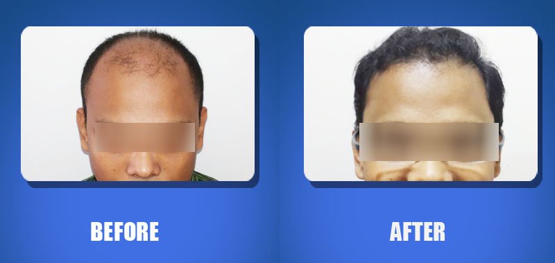 Hair Harmony and You - Bhubaneswar - Hair Harmony and You - Bhubaneswar