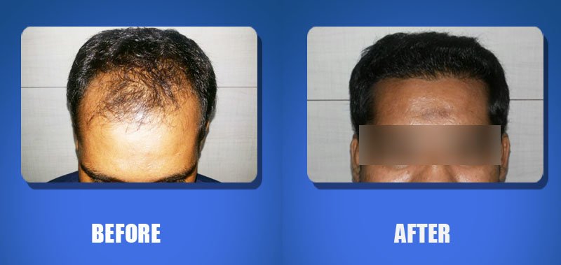 Hair Harmony and You - Bhubaneswar - Hair Harmony and You - Bhubaneswar