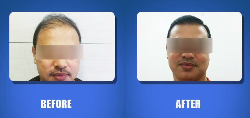 Hair Harmony and You - Bhubaneswar - Hair Harmony and You - Bhubaneswar