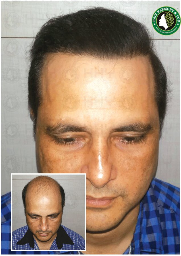 Hair Harmony and You - Mumbai - Hair Harmony and You - Mumbai