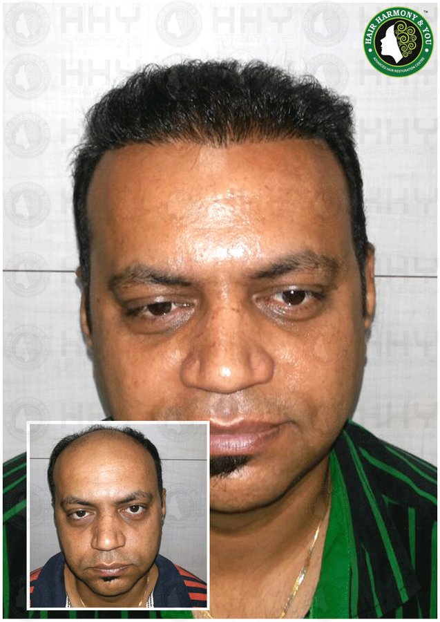 Hair Harmony and You - Mumbai - Hair Harmony and You - Mumbai