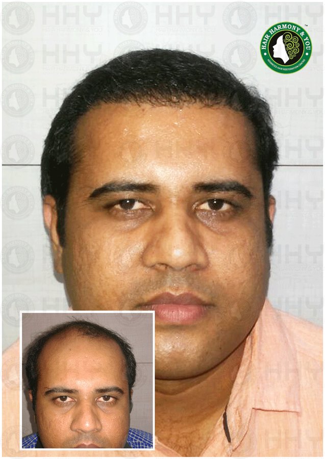 Hair Harmony and You - Mumbai - Hair Harmony and You - Mumbai