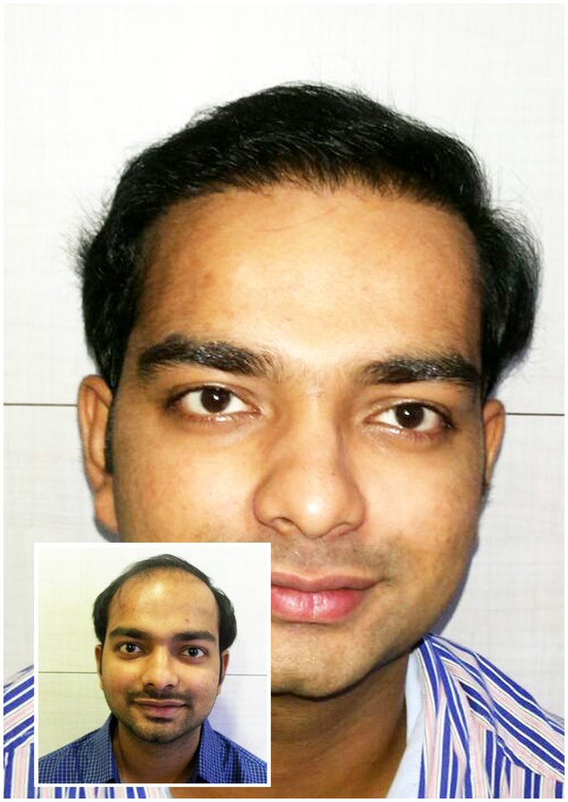 Hair Harmony and You - Mumbai - Hair Harmony and You - Mumbai