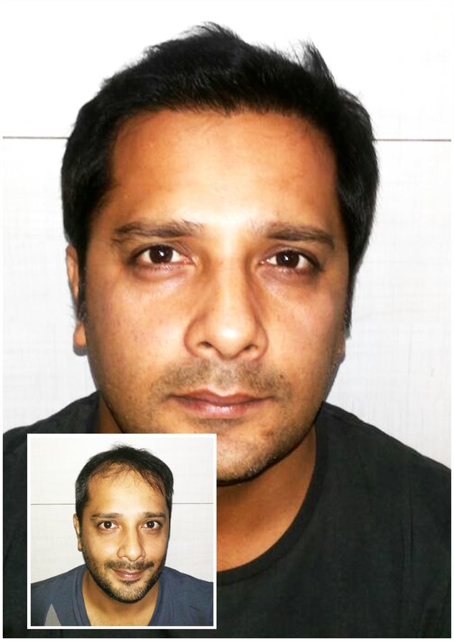 Hair Harmony and You - Mumbai - Hair Harmony and You - Mumbai