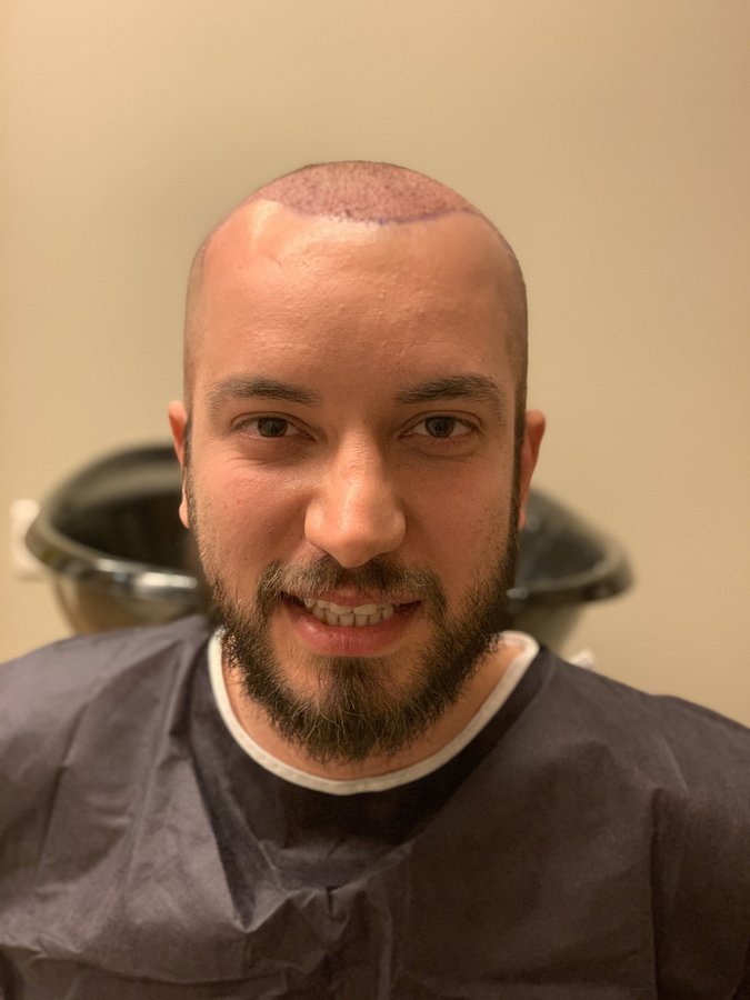 Hair Neva Hair Transplant Center - Hair Neva Hair Transplant Center