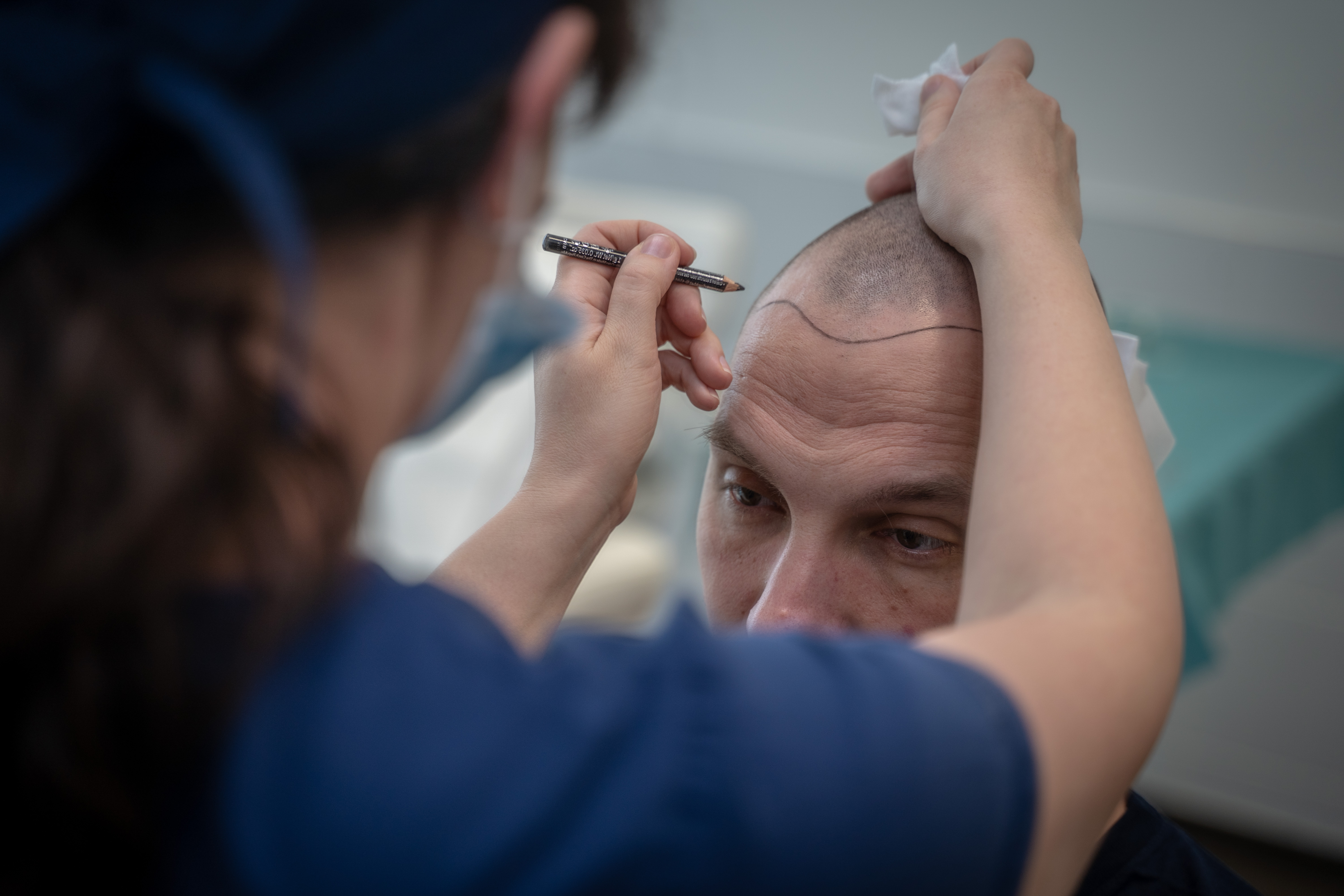 صالون قص الشعر وزراعة الشعر - Hair Palace Hair Transplant Clinic