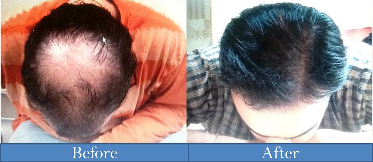 Hair Science-Mumbai - Hair Science-Mumbai