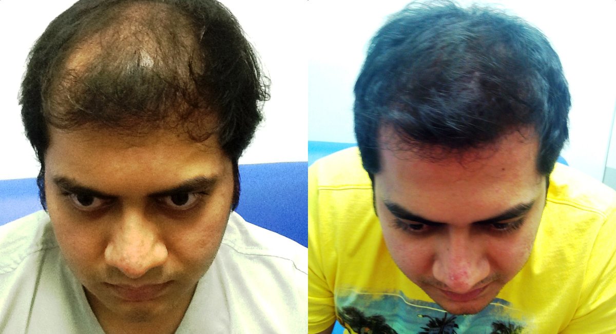 Hair Science-Mumbai - Hair Science-Mumbai