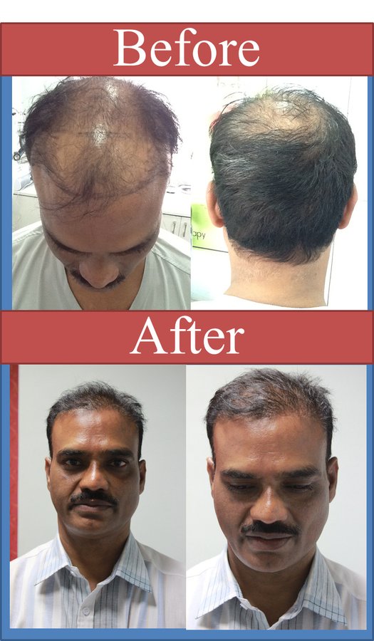 Hair Science-Mumbai - Hair Science-Mumbai