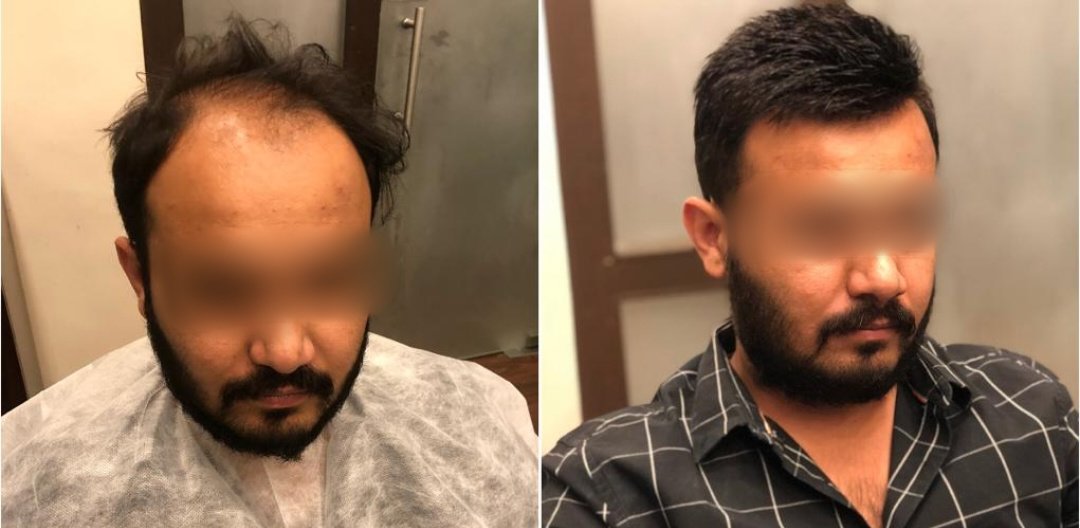 Hair Trans Studio - Hair Trans Studio