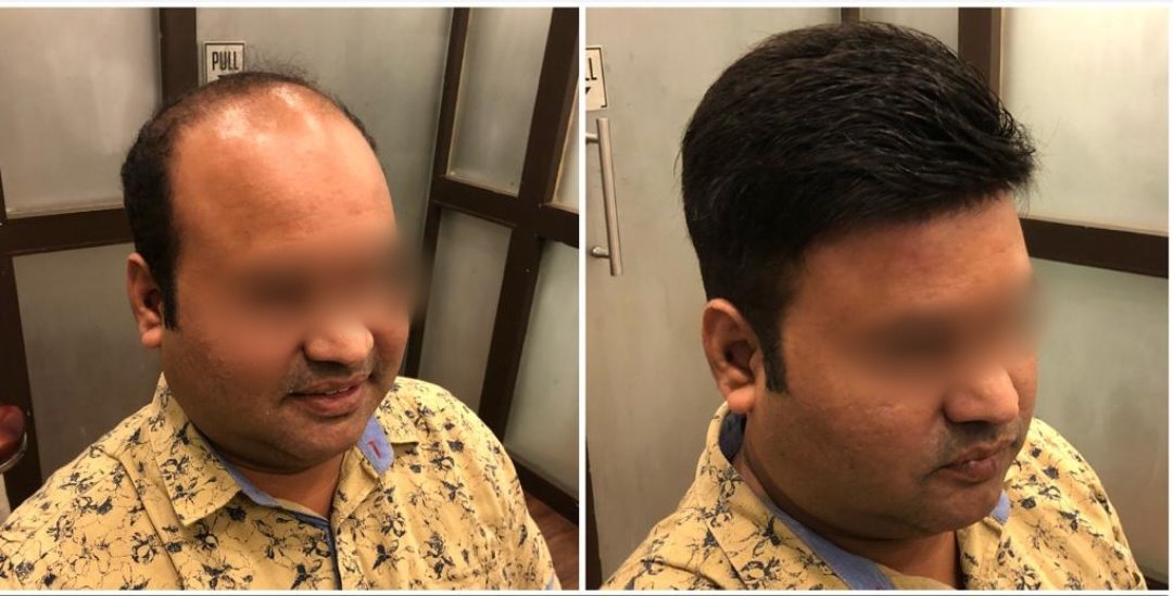 Hair Trans Studio - Hair Trans Studio