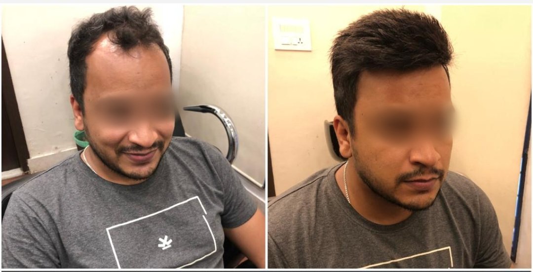 Hair Trans Studio - Hair Trans Studio