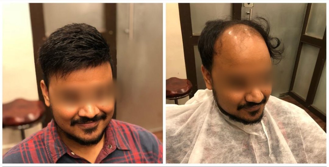 Hair Trans Studio - Hair Trans Studio