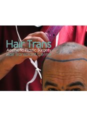 Hair Trans - Hair Trans