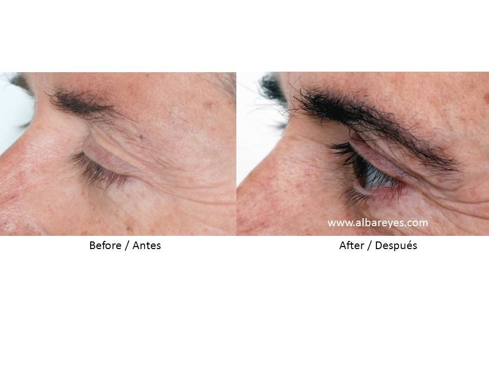 Hair Transplant Institute - Dr. Alba Reyes, MD - Hair Transplant Institute - Dr. Alba Reyes, MD