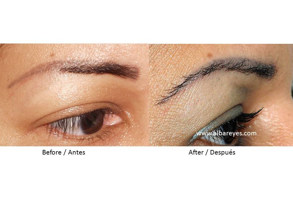 Hair Transplant Institute - Dr. Alba Reyes, MD - Hair Transplant Institute - Dr. Alba Reyes, MD