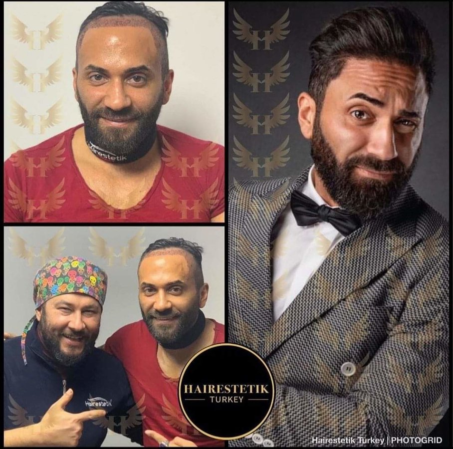 Hairestetik Turkey Hair Transplant Center - Hairestetik Turkey Hair Transplant Center