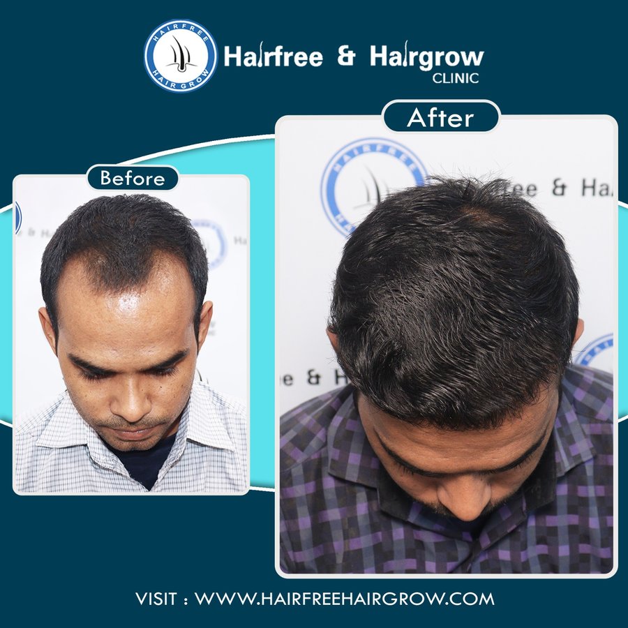 Hairfree & Hairgrow clinic - Ahmedabad - Hairfree & Hairgrow clinic - Ahmedabad