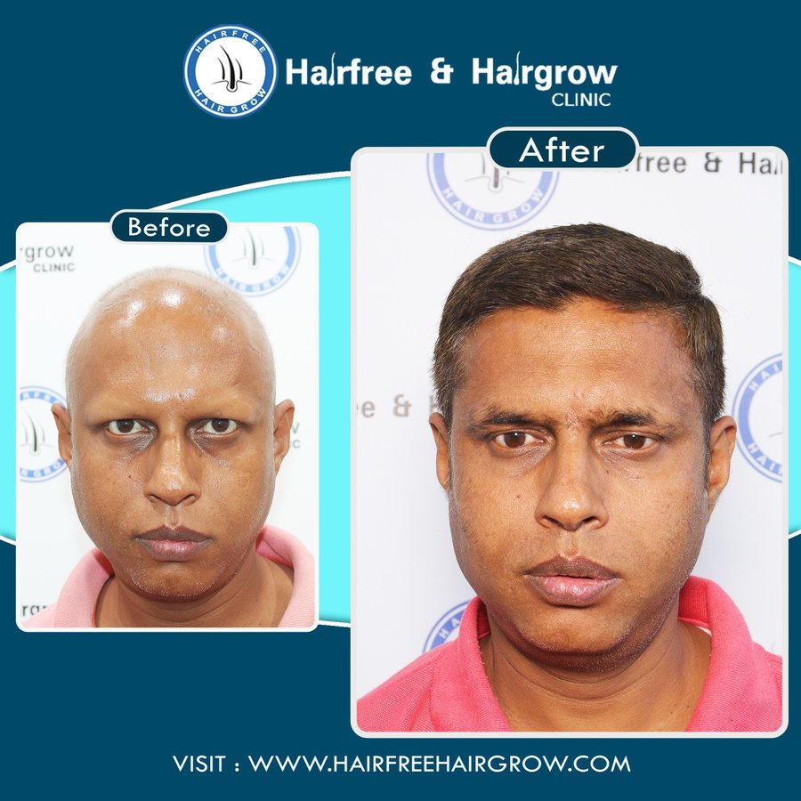 Hairfree & Hairgrow clinic - Ahmedabad - Hairfree & Hairgrow clinic - Ahmedabad