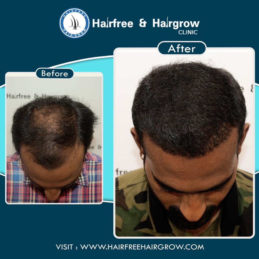 Hairfree & Hairgrow clinic - Ahmedabad - Hairfree & Hairgrow clinic - Ahmedabad