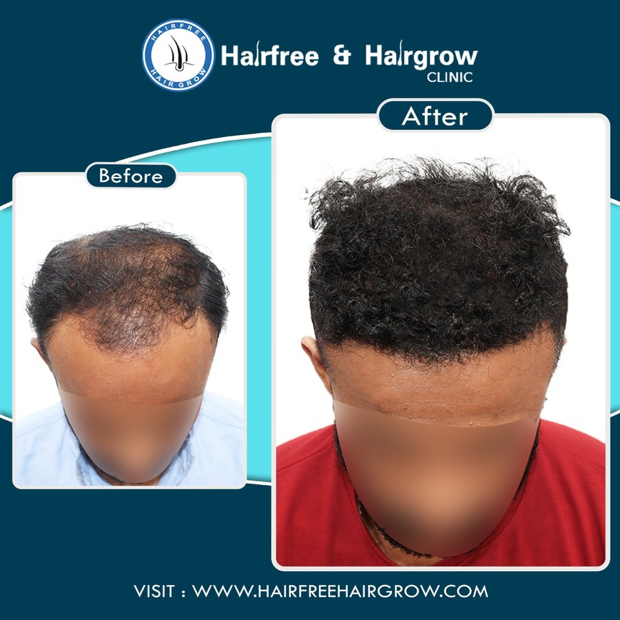Hairfree & Hairgrow clinic - Kolkata - Hairfree & Hairgrow clinic - Kolkata