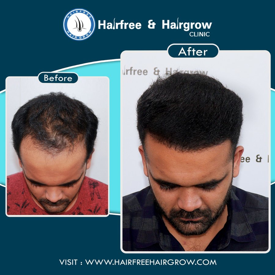 Hairfree & Hairgrow clinic - Kolkata - Hairfree & Hairgrow clinic - Kolkata