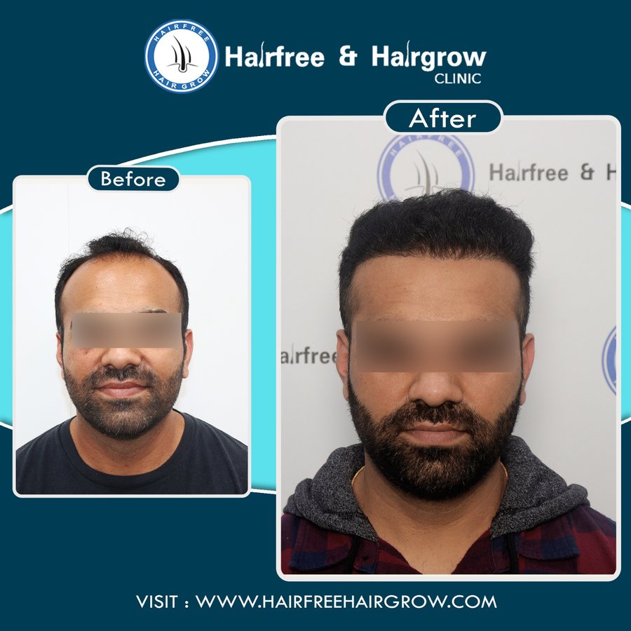Hairfree & Hairgrow clinic - Kolkata - Hairfree & Hairgrow clinic - Kolkata