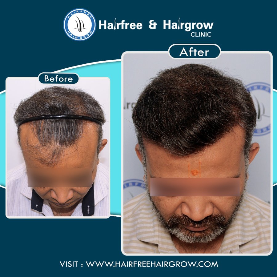 Hairfree & Hairgrow clinic - Mumbai - Hairfree & Hairgrow clinic - Mumbai