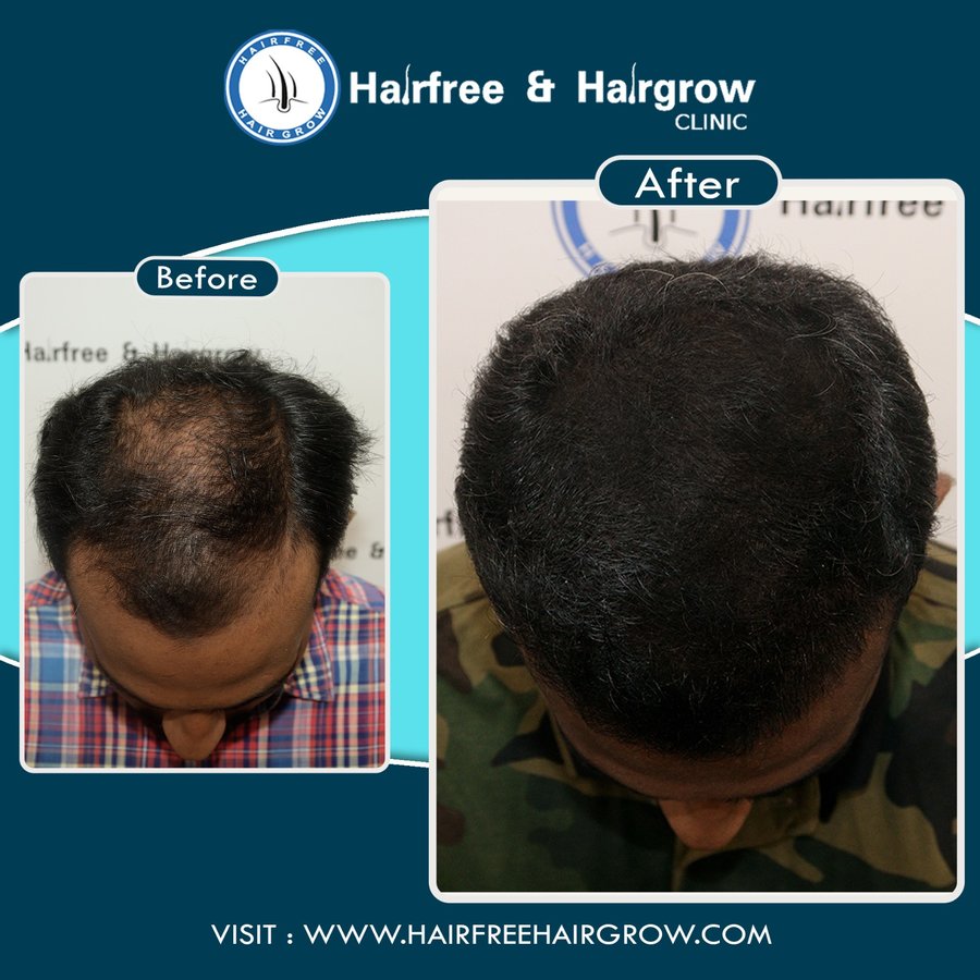 Hairfree & Hairgrow clinic - Mumbai - Hairfree & Hairgrow clinic - Mumbai