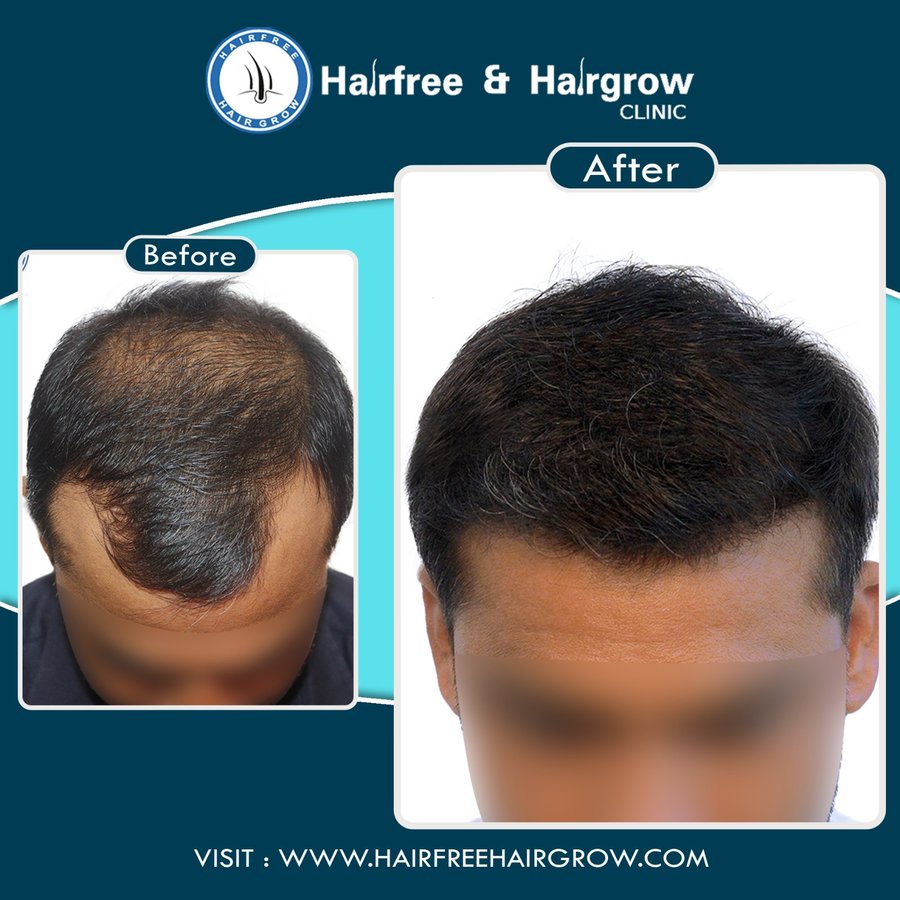 Hairfree & Hairgrow clinic - Mumbai - Hairfree & Hairgrow clinic - Mumbai