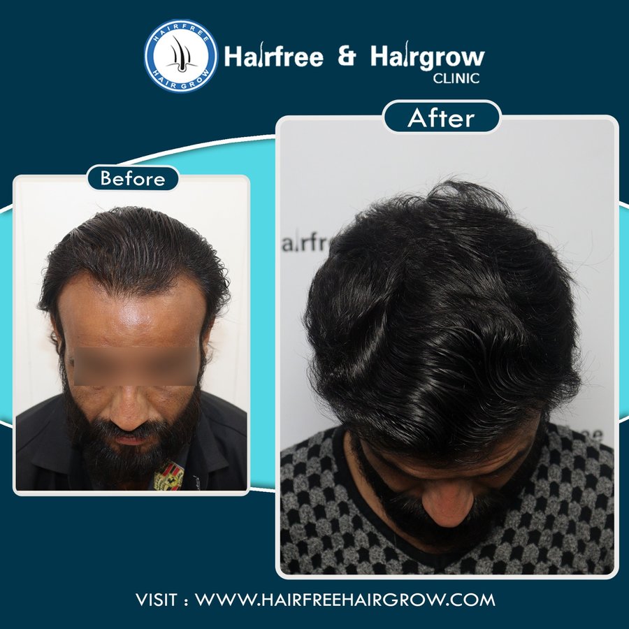 hairfree & hairgrow clinic - Silvassa - hairfree & hairgrow clinic - Silvassa