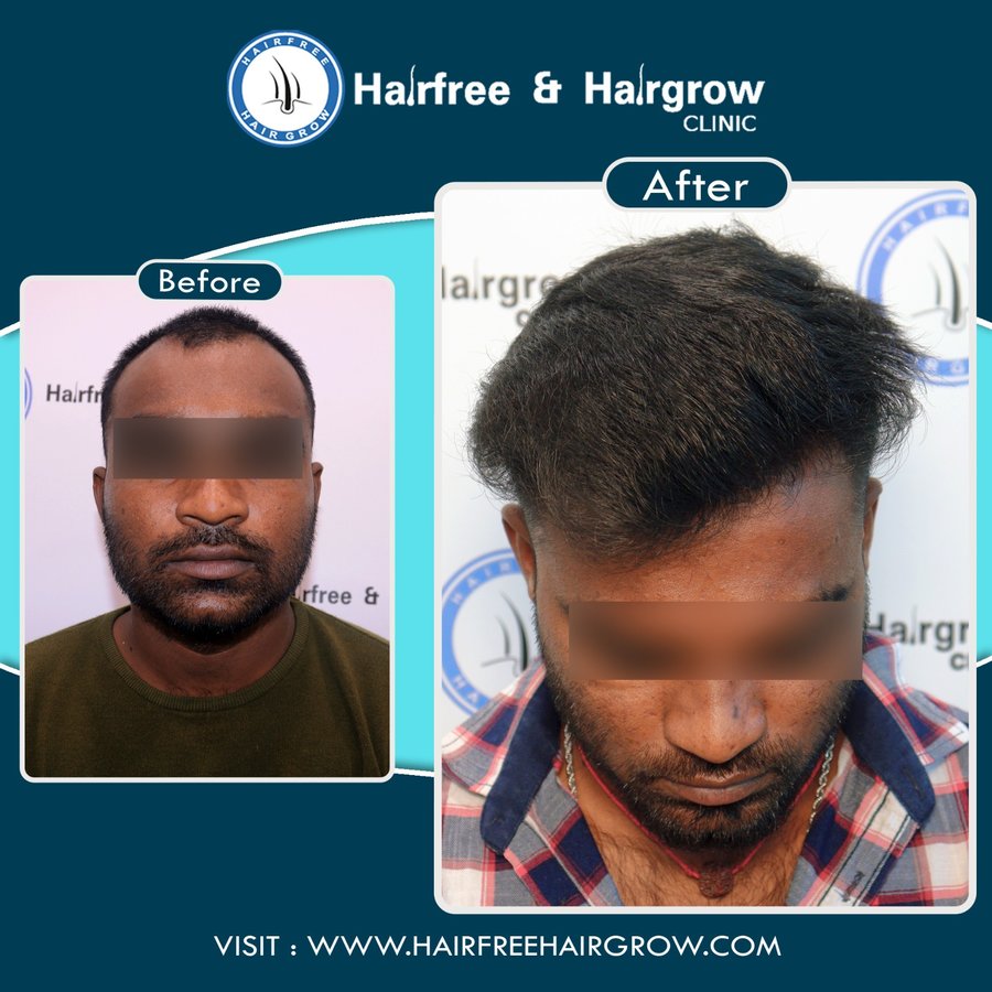 hairfree & hairgrow clinic - Silvassa - hairfree & hairgrow clinic - Silvassa