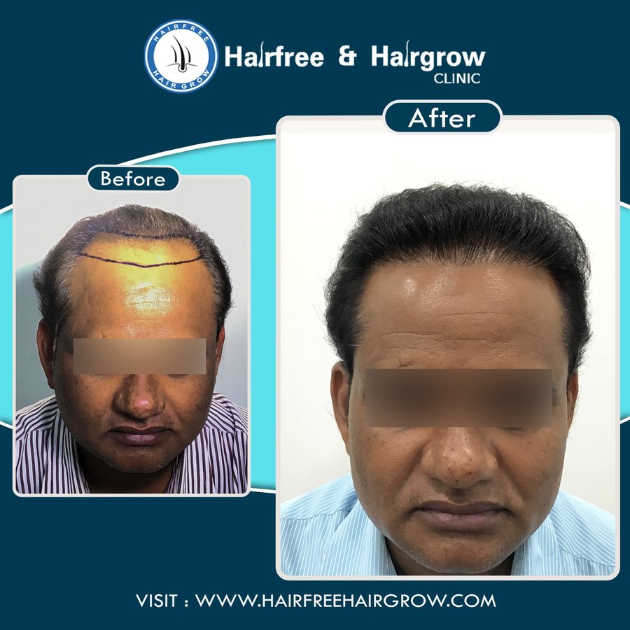 hairfree & hairgrow clinic - Silvassa - hairfree & hairgrow clinic - Silvassa