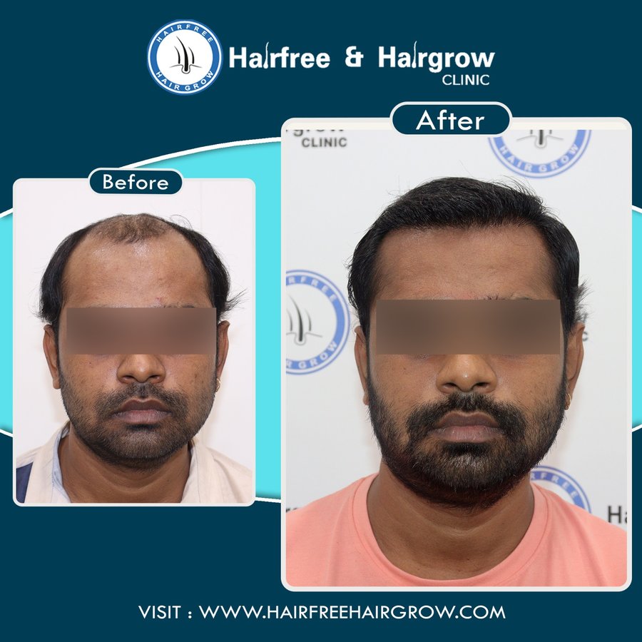 hairfree & hairgrow clinic - Silvassa - hairfree & hairgrow clinic - Silvassa