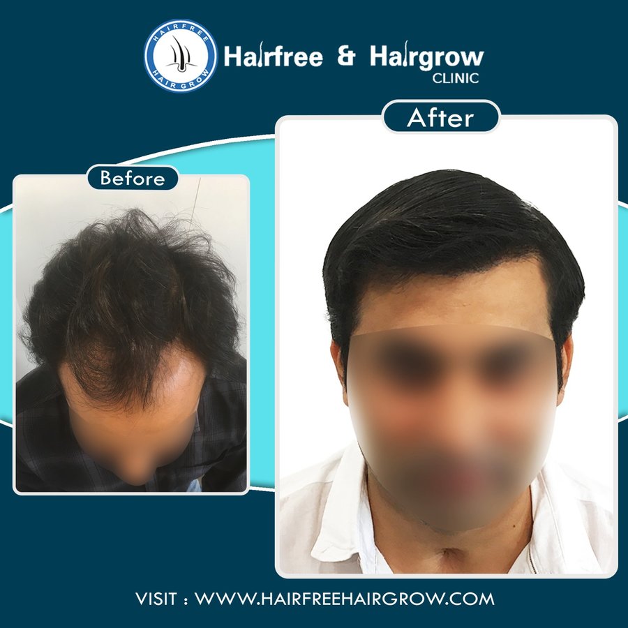 hairfree & hairgrow clinic - Surat - hairfree & hairgrow clinic - Surat