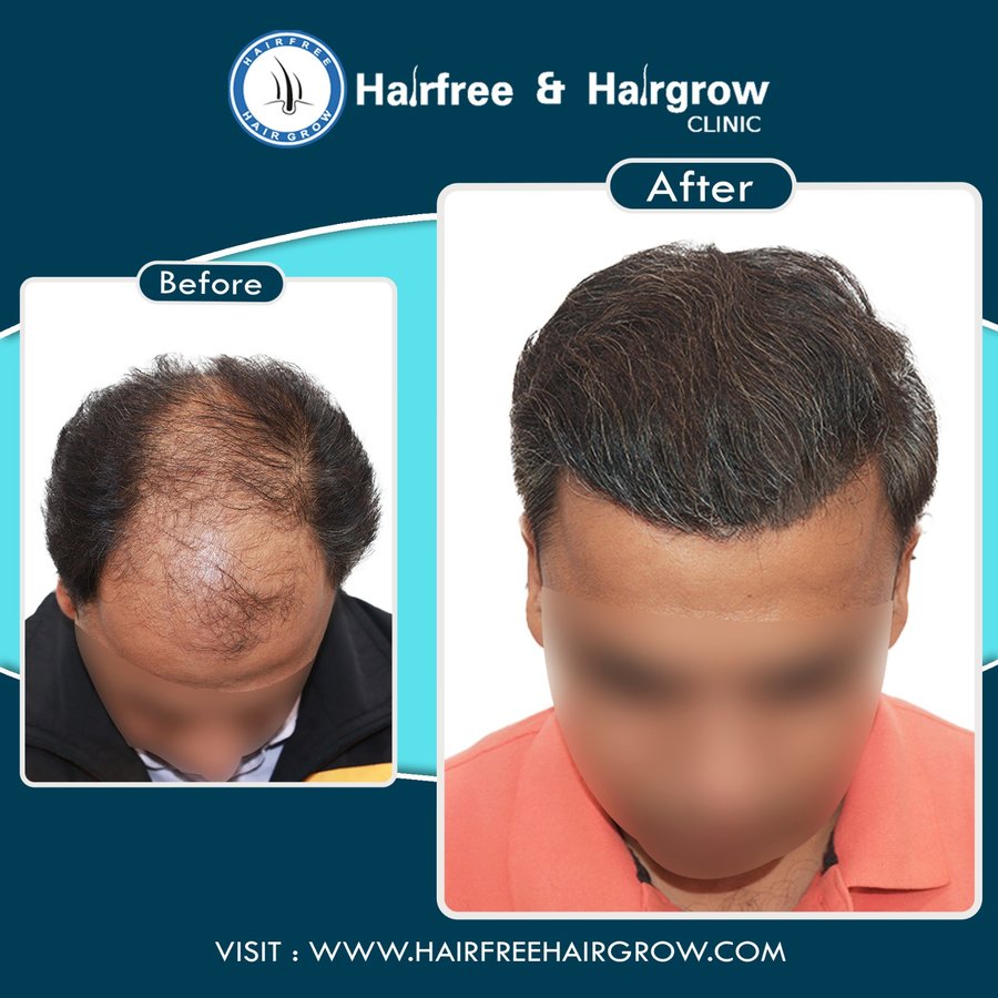 hairfree & hairgrow clinic - Surat - hairfree & hairgrow clinic - Surat