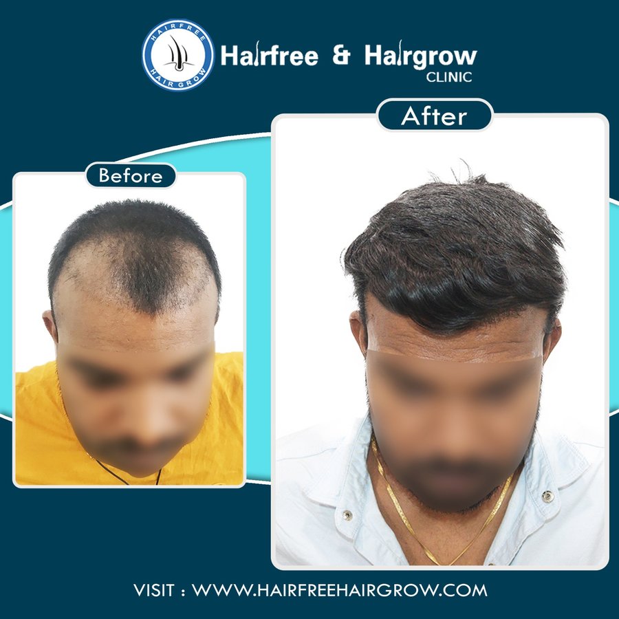 hairfree & hairgrow clinic - Surat - hairfree & hairgrow clinic - Surat
