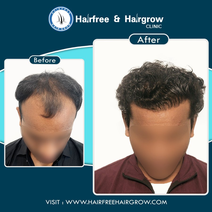 hairfree & hairgrow clinic - Surat - hairfree & hairgrow clinic - Surat