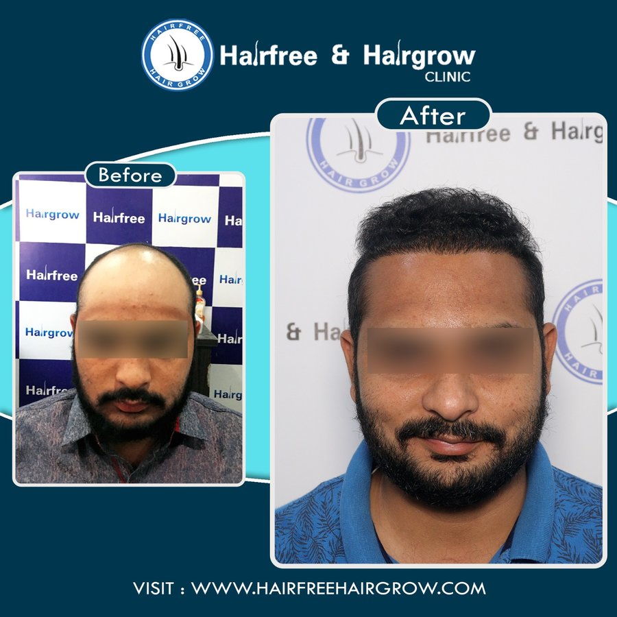 hairfree & hairgrow clinic - Surat - hairfree & hairgrow clinic - Surat