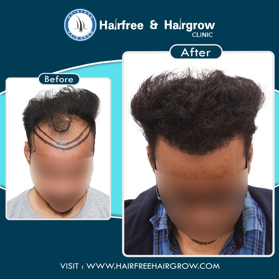 hairfree & hairgrow clinic - Vapi - hairfree & hairgrow clinic - Vapi