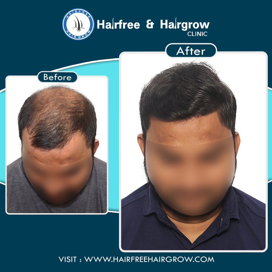 hairfree & hairgrow clinic - Vapi - hairfree & hairgrow clinic - Vapi