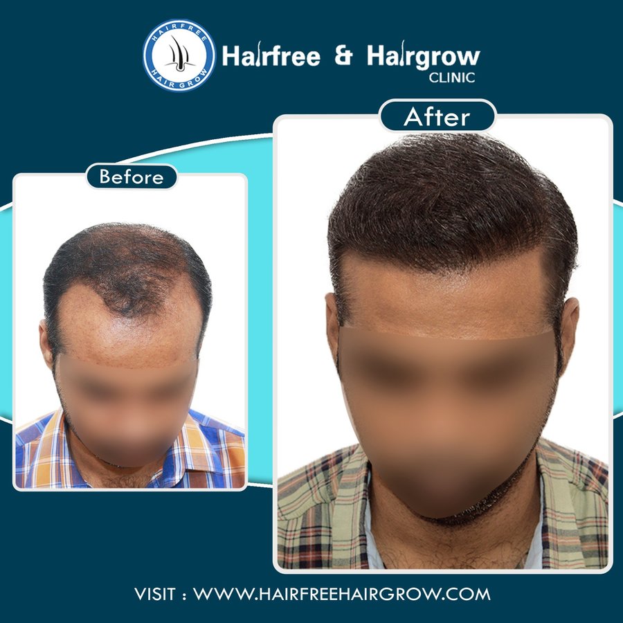 hairfree & hairgrow clinic - Vapi - hairfree & hairgrow clinic - Vapi